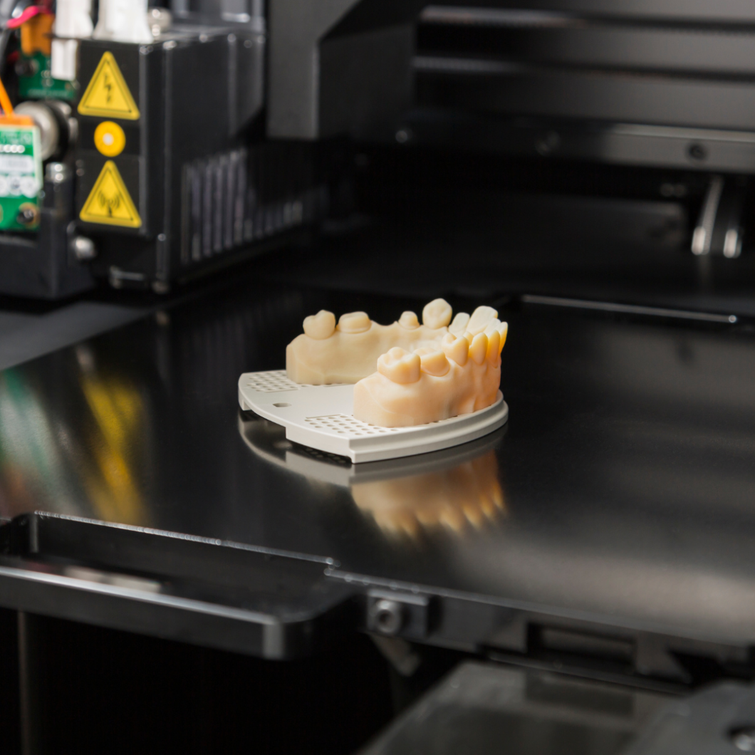 3D printing in dentistry a denture