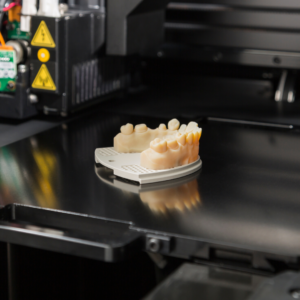 3D printing in dentistry a denture