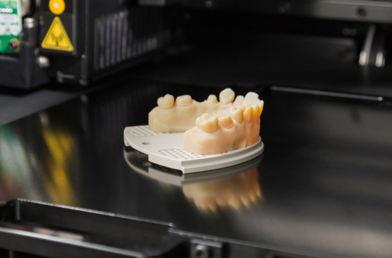 3D printing in dentistry a denture